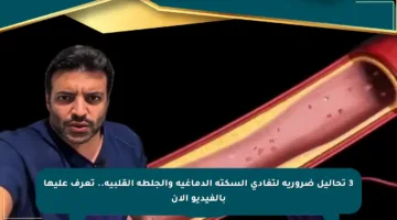 3 تحاليل ضرورية لتفادي السكتة الدماغية والجلطة القلبية.. تعرف عليها بالفيديو الآن